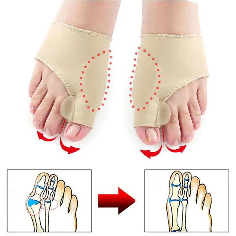 Toe Separator Hallux Valgus Bunion Corrector Hammer Toe Straightener - Supersell